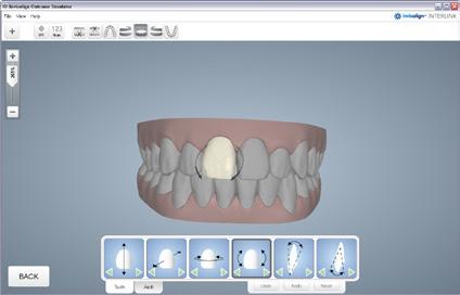 STEP 4: ADJUST INDIVIDUAL TEETH Click on the tooth that needs to be adjusted Tooth will be highlighted Select