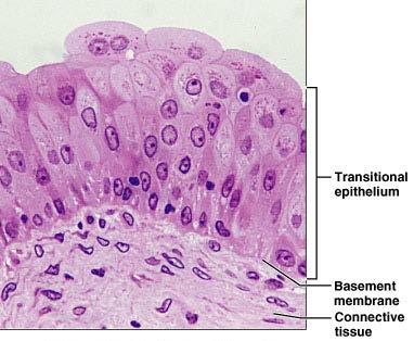Transitional Epithelium Description Basal cells usually cuboidal or columnar Superficial cells domeshaped or squamous