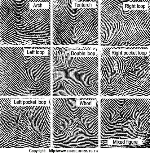 111 2) Here are the different patterns of fingerprints: 3) Rare case: NO FINGERPRINTS? In very rare cases there are people that do not have prints. Not on their fingers, their palms or their feet.