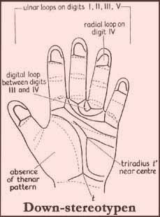 211 Medical scientist have discovered that the hand can be used as an indicator for medical problems.