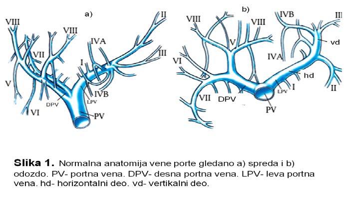 Normalna anatomija vene porte Portna vena nastaje u retroperitoneumu, ulivanjem lijenalne u gornju mezenteričnu venu iza vrata pankreasa i bulbusa duodenuma.