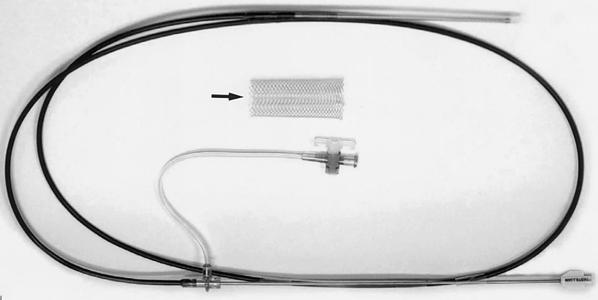 Slika 1: Enteralni Wallstent sa nosačem od 10 F Stent se može plasirati samo pod kontrolom rendgenskopije ili u kombinaciji endoskopije sa rendgenskopijom.
