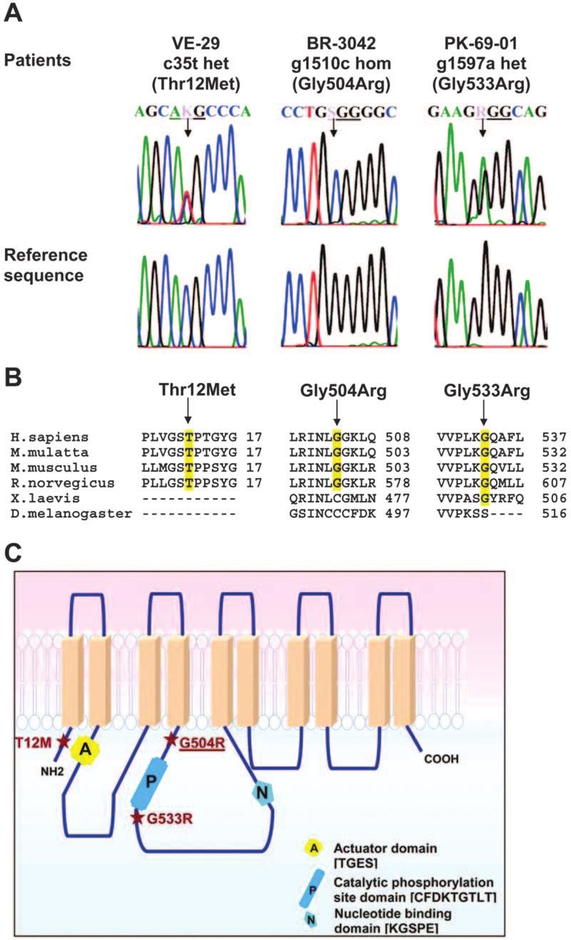 (A) Electropherograms of fragments of the ATP13A2 genomic sequence. The position of the mutations identified in this study is indicated.