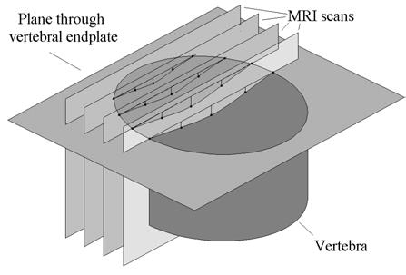 The geometry and shape of the human intervertebral disc middle line is drawn.