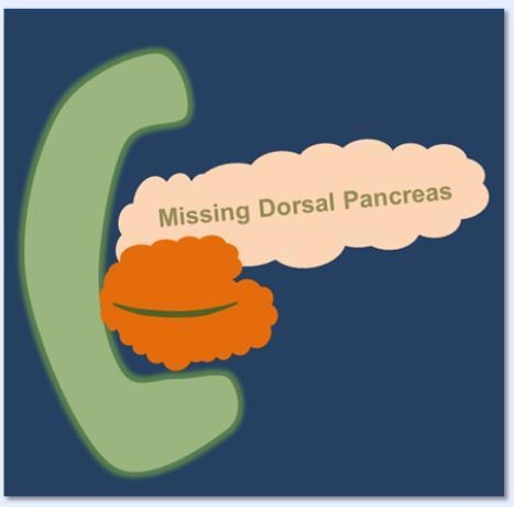 Truncated pancreas