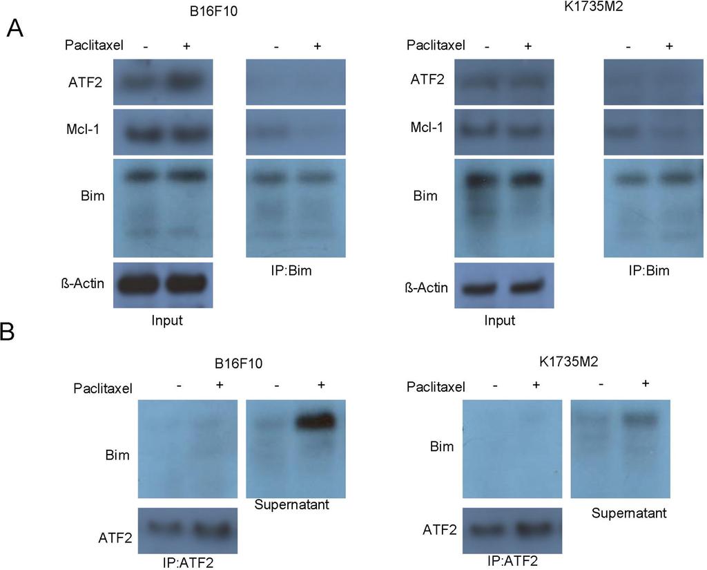 Figure 5: Mitochondrial ATF2 does not directly bind to Bim following paclitaxel treatment. A. The association of Bim with ATF2 and Mcl-1 was detected by reciprocal immunoprecipitation assays.