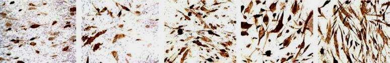 MHCII + Area/field (μm 2 x 10 3 ) Fat cells/field Testosterone induces Myogenesis in pluripotent Stem Cells 150 Myogenic Cells 40 Fat Cells 100 50 30 20 10 0 0 3 30 100 300 T (nm) 0 0 3 30 100 300 T