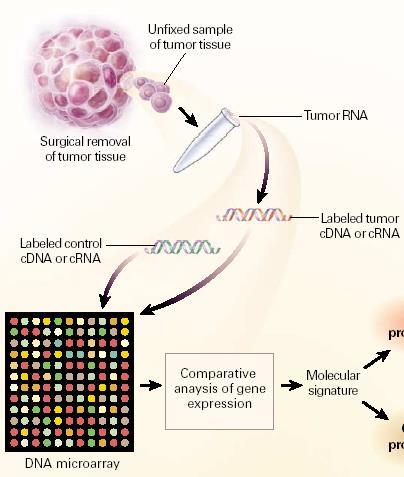 Genomic Profiling in Early Stage Cancer Oncotype Dx 21-Gene Recurrence Score Assay Fixed (stored) tissue Surgical removal of tissue Recurrence score results