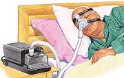 Why do I need CPAP, AutoPAP or Bilevel? Appointment Information The sleep doctor/nurse you saw today was: Dr. Brown Alace Anaya CNP Elaine Clanon CNP Dr. Grigg Damberger Dr.