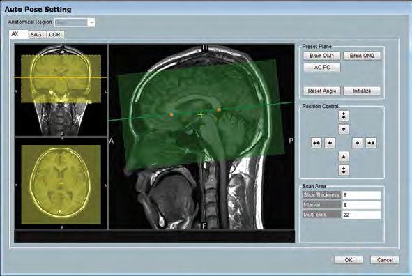 RADAR Motion compensation with RADAR provides diagnostic results even when imaging uncooperative or infirm patients.