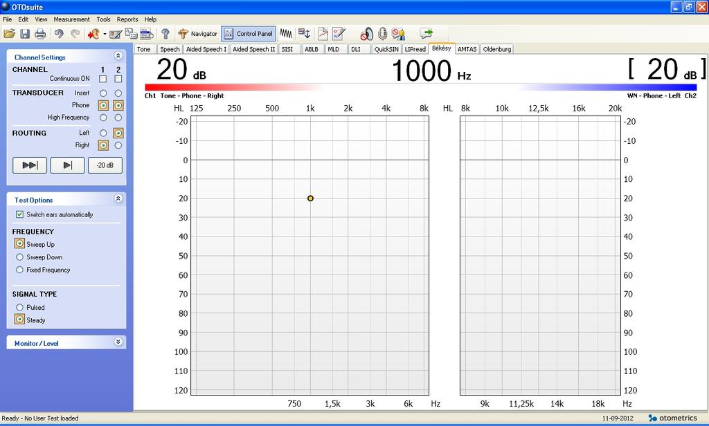 Sweep Frequency results 3.14.8 LIPread The OTOsuite LIPread speech test is designed to integrate multi-modal speech tests for playback in the OTOsuite software.