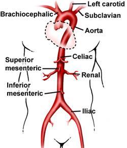 Normal Anatomy of Aorta and Branches http://www.