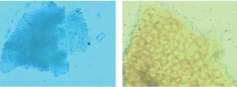 3 X40 Parenchyma cells with Fig.