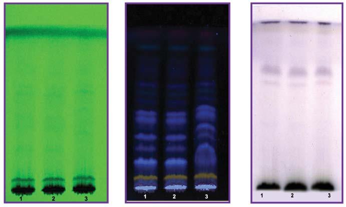 118 Thin Layer Chromatography (Alcohol Extract) Fig.VI Fig.VII Fig.
