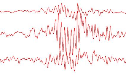 The Human EEG A data source for