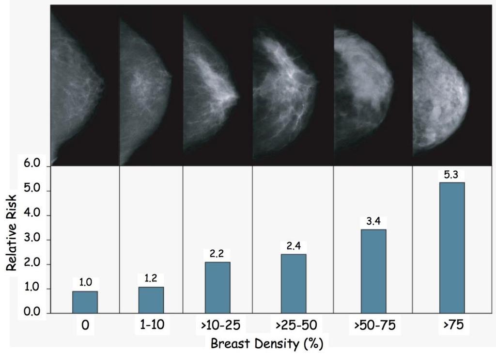 Mammographic breast density Not perceived density on breast exam.
