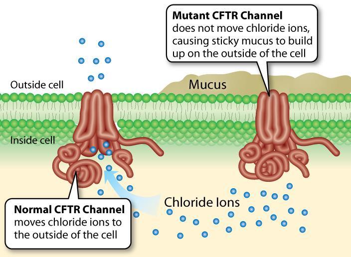 Cystic Fibrosis Mutation in