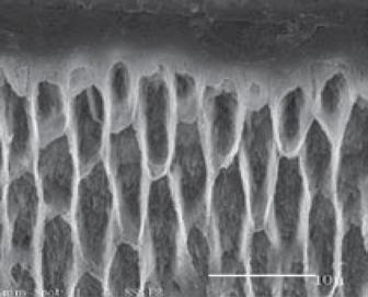 micromechanical bonding. A typically prepared dentin surface will contain a smear layer as shown in Figure 3.