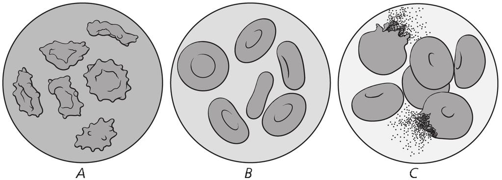 The diagram shows changes to red blood cells placed in solutions of varying concentrations. Identify the solutions as hypotonic, isotonic, or hypertonic to the cells. Explain your responses.