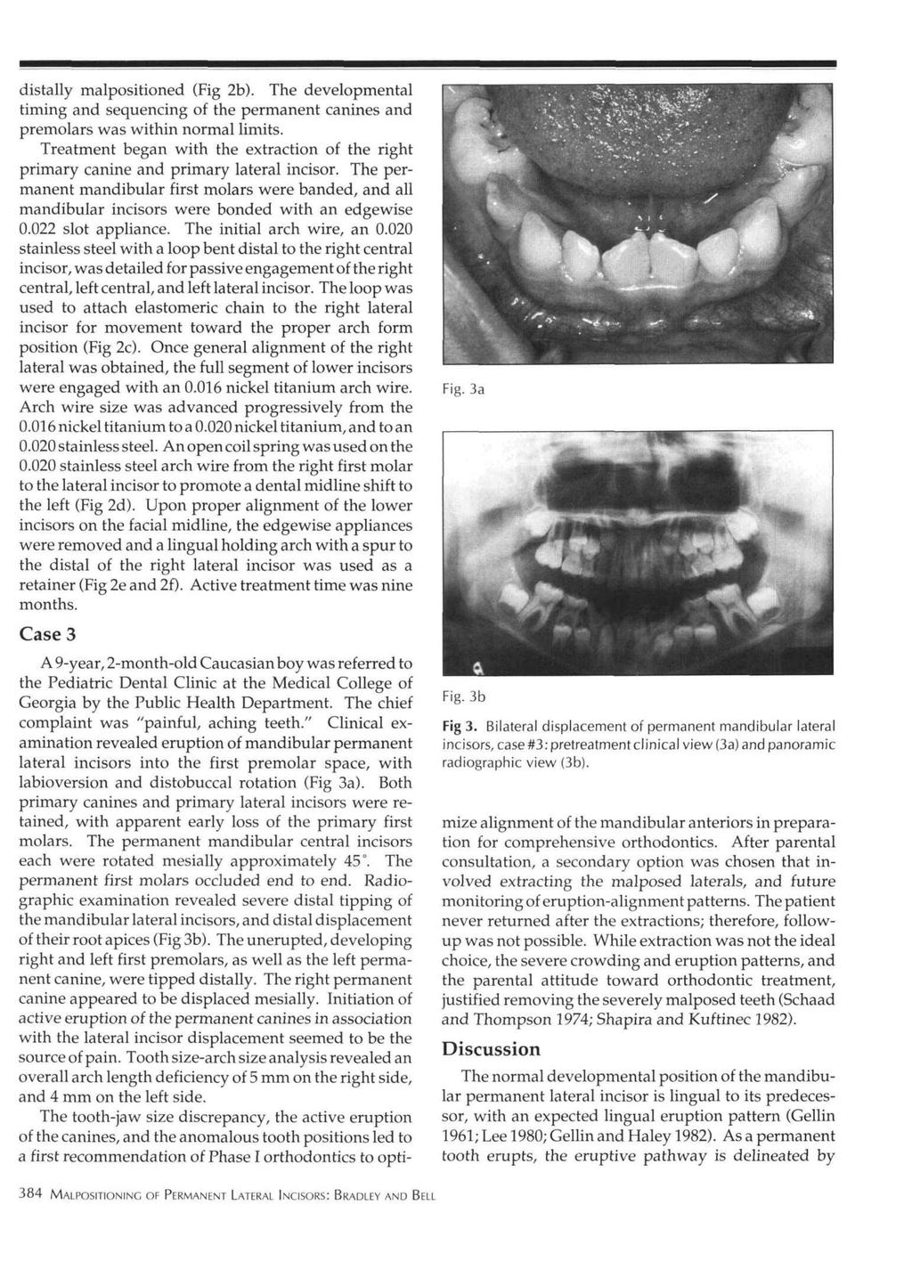 distally malpositioned (Fig 2b). The developmental timing and sequencing of the permanent canines and premolars was within normal limits.