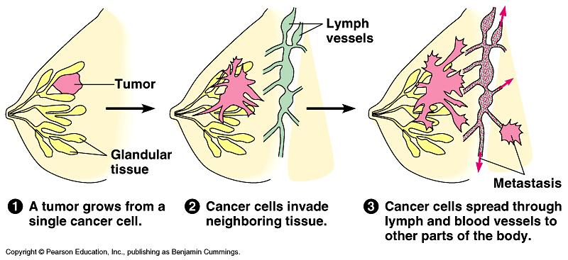 Cancer: A mistake in the Cell Cycle In later stages, cancer cells enter the circulatory systems and spread throughout the body,