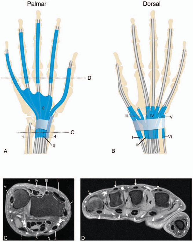 870 NIEUWENHUIS ET AL Figure 1. Tendons and tendon sheaths (shown in blue) of the hand and wrist. A, Schematic illustration of the palmar side of the hand and wrist.