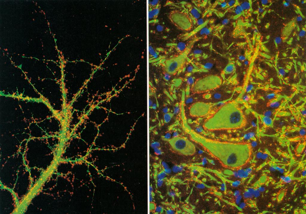 Special stains for synapses (red) show their high density on dendrites and somas on CNS neurons. The sequence of steps in synaptic transmission: 1. 2.