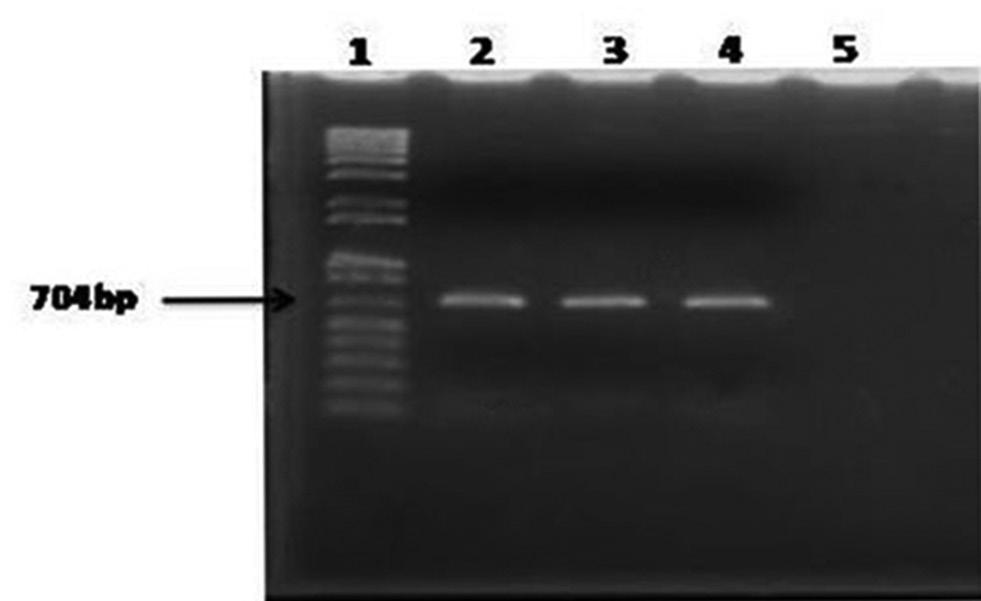 Figure-1: Results of polymerase chain reaction for amplification of 16S rrna of Escherichia coli isolates of chicken. Lane 1: 100 bp-12 kb size DNA marker (Trackit, Invitrogen, USA); 2: DNA of E.