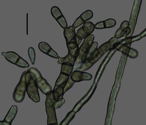 frequently intercalary. Xenopenidiella nigrescens Attili-Angelis, A.P.M.