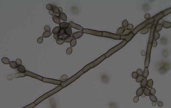 hila, 5.5 9 3 4 µm. Chlamydospores not observed.