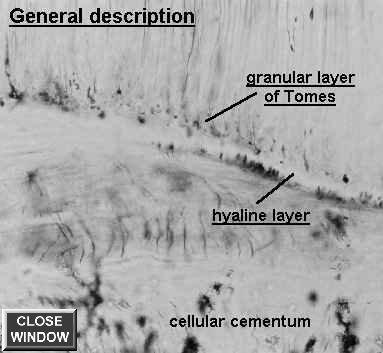 Dentin: Granular layer of Tomes/ Hyaline layer of Hopewell-Smith Granular layer of Tomes: A granular appearing layer of dentin underlying the cementum that covers the root.