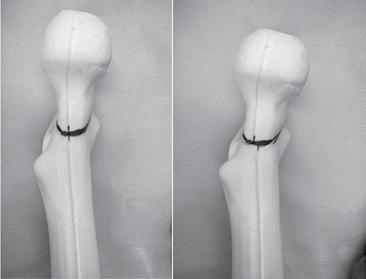 (Figure 7) A B Figure 4. A) Image of bone model fixated at the testing machine at pre- -test; B) Image of bone model fixated at the testing machine during the 5mm displacement assay (Step 1).