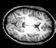 MRI vs. fmri Functional MRI (fmri) studies brain function. MRI vs.