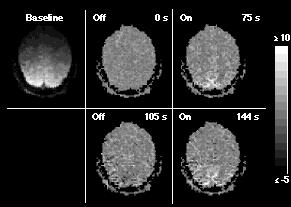 Brain Activity fmri Activation Flickering Checkerboard OFF (60 s) - ON (60 s) -OFF (60 s) - ON (60 s) - OFF (60 s) Time Source: Kwong et al.