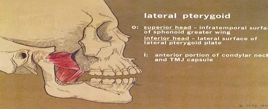 3. Lateral pterygoid: *add to the insertion the articular disc.