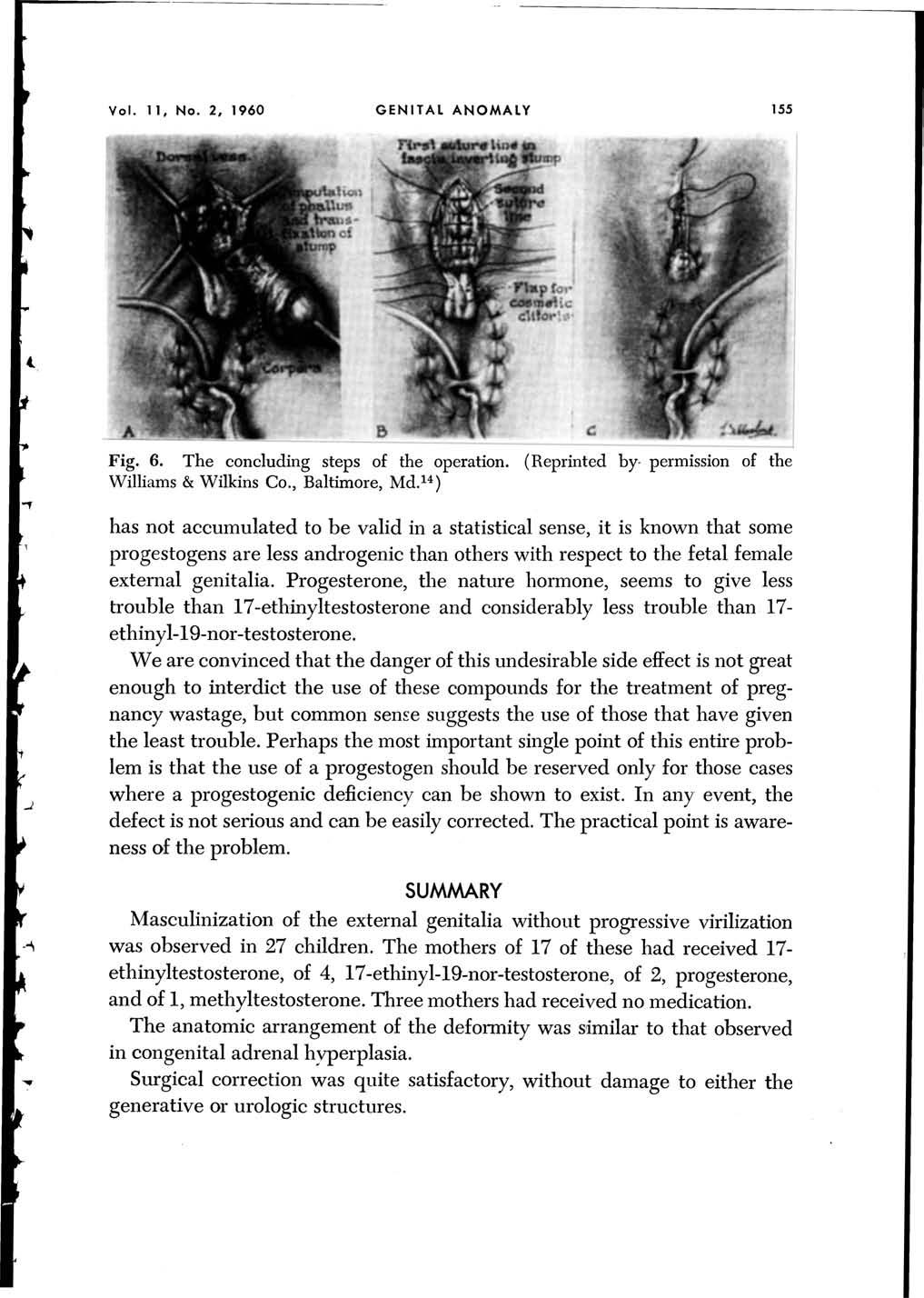 Vol. 11, No.2, 1960 GENITAL ANOMALY 155 Fig. 6. The concluding steps of the operation. (Reprinted by- permission of the Williams & Wilkins Co., Baltimore, Md.