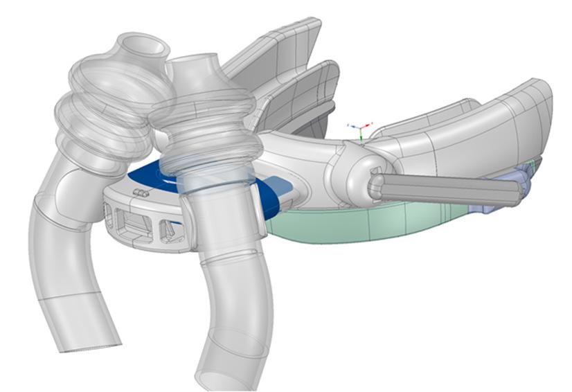 Oventus Airway Technology Product Pipeline.