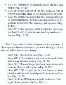 (ULNAR STYLOID AND MCPs) look for enhancement and assoc synovitis; confirm on plain film -GCT TENDON SHEATH (VOLAR FLEXOR TENDON; T1/T2