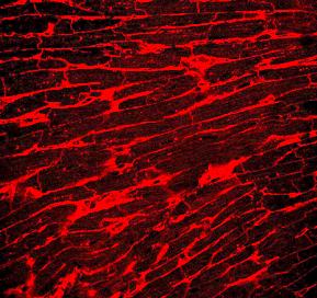 isolated cardiomyocytes from the