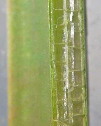 Parenchyma makes up a large part of plant tissue the soft