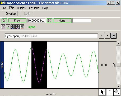 Lesson 5: EEG 1 Page 9 4. Using the I-Beam tool, select the area of eyes closed data from Time 0 to the first event marker.