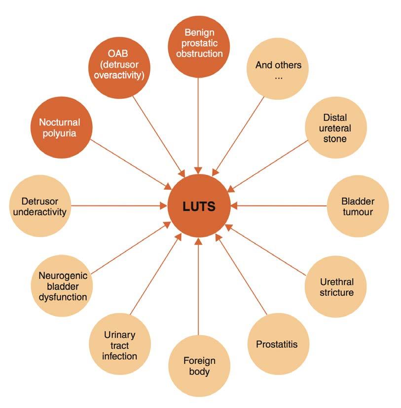 Causes of Male LUTS: Urocentric Gratzke C et al.