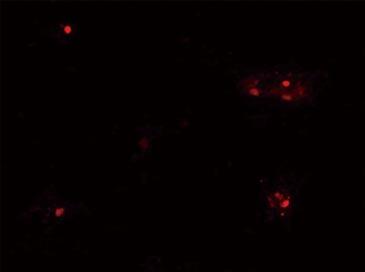 Gene expression (C) of PDX1-monomeric red fluorescent protein (mrfp)/insulin-enhanced green fluorescent