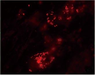 Figure 4 Immunofluorescence staining of differentiated PDX1- monomeric red fluorescent