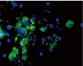 Insulin/Alexa-Fluor488 (green) stains insulin within PDX1 + infected cells (yellow).