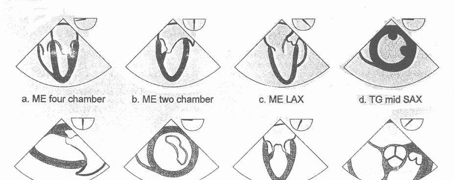Guidelines for performing a comprehensive intraoperative multiplane TEE examination: Recommendations of the ASE Council on intraoperative echocardiography and the SCA Task Force for certification in