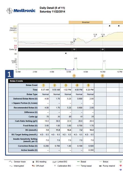 REVIEWING CARELINK PERSONAL REPORTS DAILY DETAIL REPORT This table will list all Bolus Events up to ten. Statistics for each bolus event is listed under the designated number.
