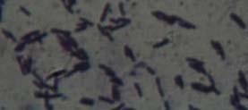 Spread plate in MRS agar, e. Lactobacillus acidophilus in MRS agar, f. L. lactus in MRS agar, g.