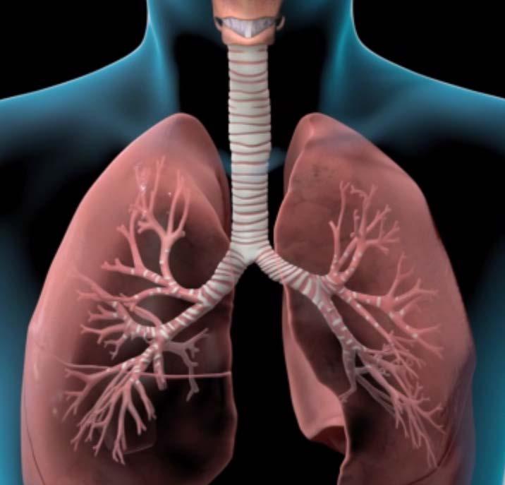 COPD Arises From