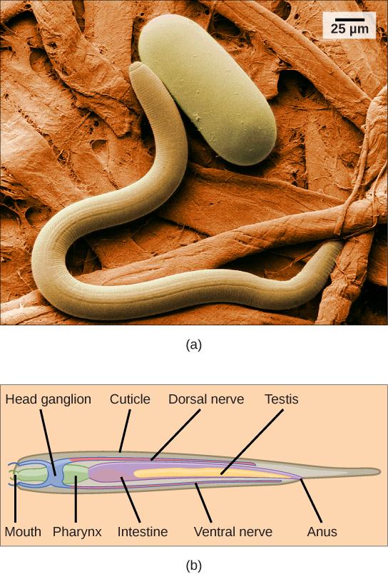 (a) An scanning electron micrograph of the nematode Heterodera glycines and (b) a schematic representation of the anatomy of a nematode are shown.